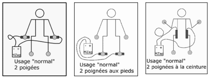 placement-electrodes-zapper-clark
